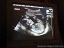 baby.thumbnail.jpg